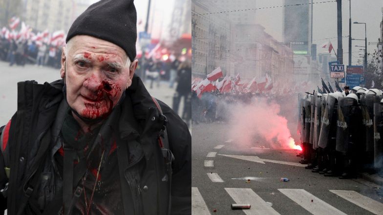74-letni fotoreporter "Tygodnika Solidarność" POSTRZELONY gumową kulą na Marszu Niepodległości. Policja: "Jest nam PRZYKRO"