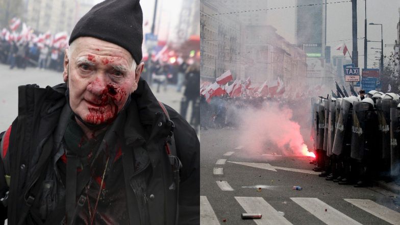 Tomasz Gutry postrzelony na Marszu Niepodległości 