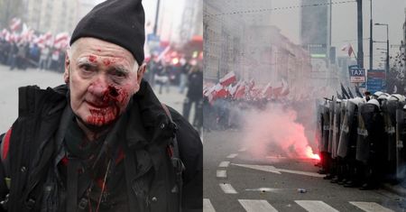 74-letni fotoreporter "Tygodnika Solidarność" POSTRZELONY gumową kulą na Marszu Niepodległości. Policja: "Jest nam PRZYKRO"