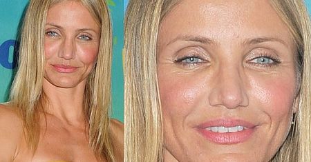 Co się stało z twarzą Cameron Diaz? (PORÓWNAJCIE!)