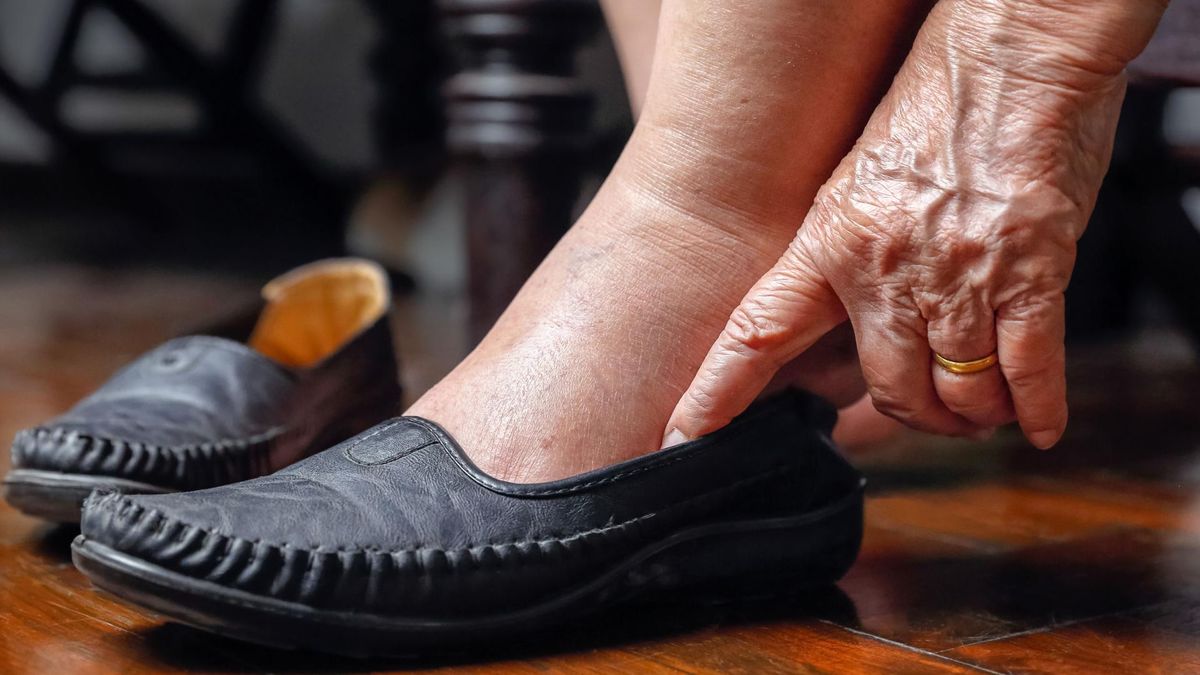 Spuchnięte kostki mogą być objawem poważnych dolegliwości