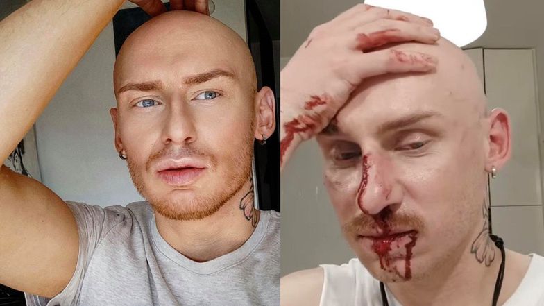 Jacek Szawiola został pobity