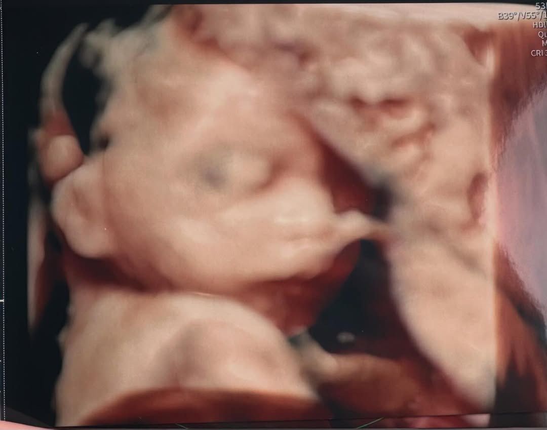 Marta Kubacka jest w ciąży