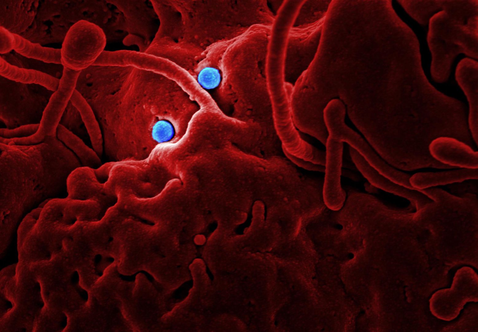 mers-cov