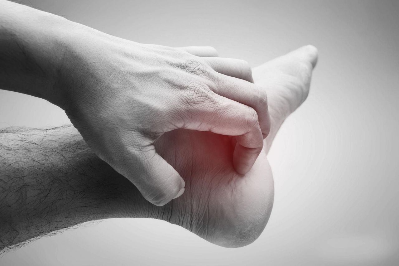 Ostroga piętowa - domowe sposoby, leczenie, zapobieganie nawrotom