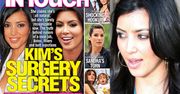 Kim Kardashian miała operację plastyczną?!