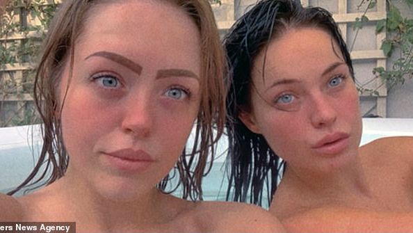 Amputowano jej nogi po kąpieli w jaccuzzi