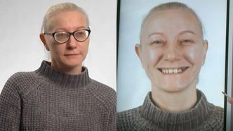 OGROMNA metamorfoza uczestniczki programu Małgorzaty Rozenek. Nienawidziła swoich zębów i piersi. Tak teraz wygląda (FOTO)