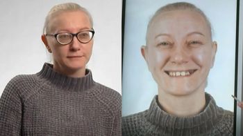 OGROMNA metamorfoza uczestniczki programu Małgorzaty Rozenek. Nienawidziła swoich zębów i piersi. Tak teraz wygląda (FOTO)