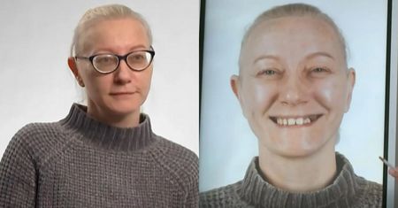 OGROMNA metamorfoza uczestniczki programu Małgorzaty Rozenek. Nienawidziła swoich zębów i piersi. Tak teraz wygląda (FOTO)