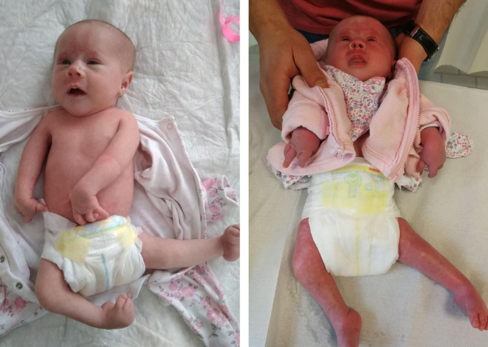 Julka wymaga stałej rehabilitacji