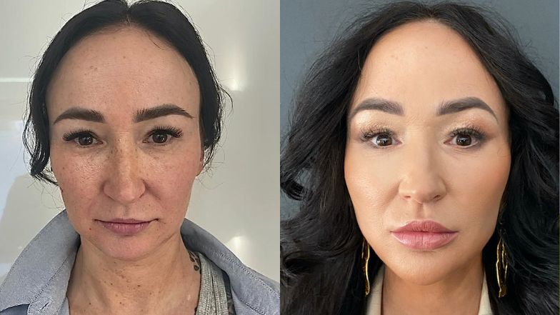 "Młodość na zamówienie". Jak zmieniły się bohaterki nowego programu o metamorfozach?