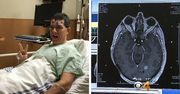 "Czuję się świetnie" - mówi człowiek, z którego mózgu lekarze wycięli 98 guzów
