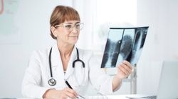 Nietypowe objawy raka płuc. Niepalący też powinni uważać 