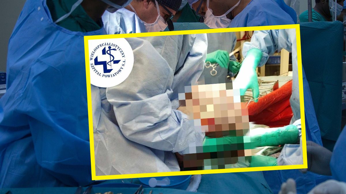 Lekarze z Tarnowskich Gór wycięli pacjentce ogromnego guza