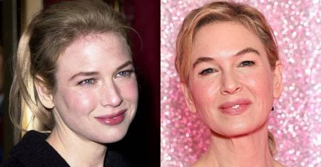 Lekarz wylicza, co Renee Zellweger poprawiła w swojej urodzie: "Niepokojący jest fakt, że jej oczy wyglądają na zamknięte i kocie"