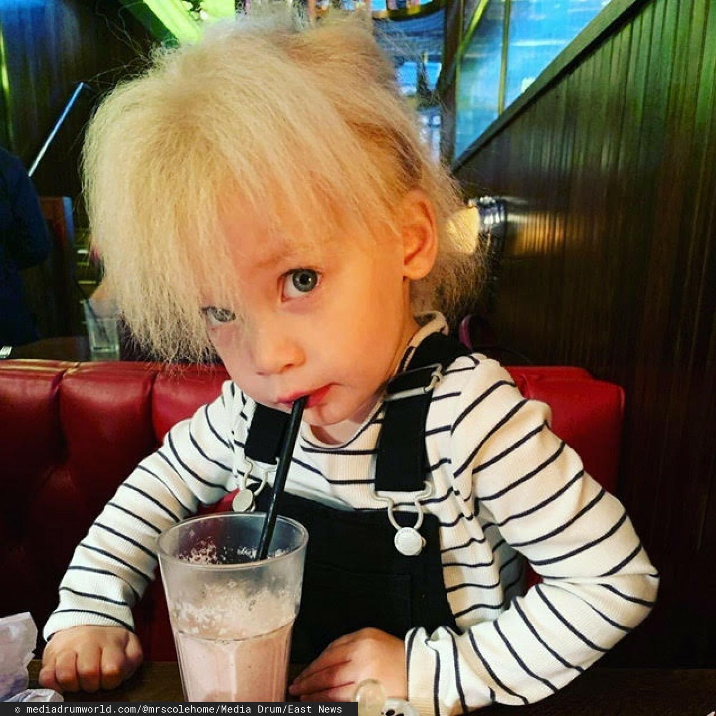 Keira cierpi na rzadką chorobę