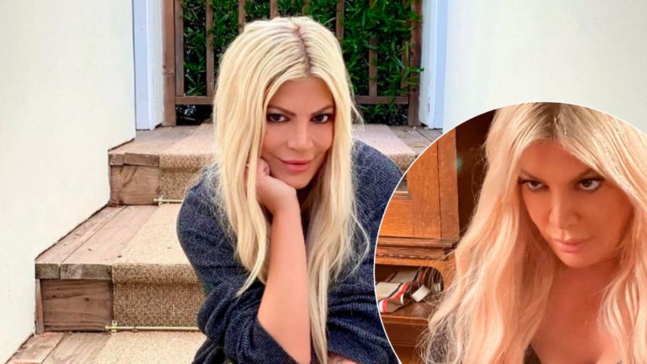 Tori Spelling musi iść pod nóż. Ma biust do wymiany