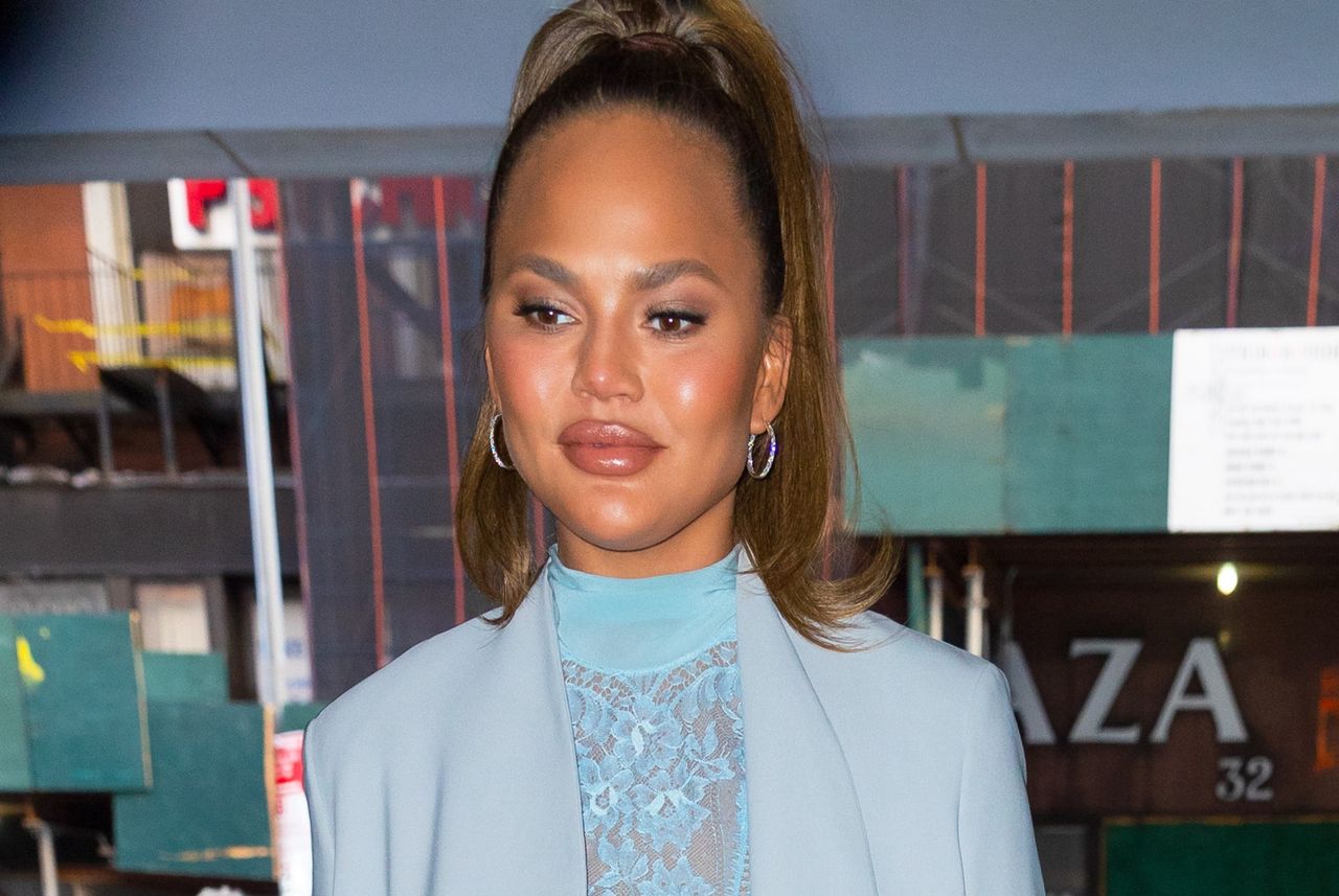 Chrissy Teigen otwarcie mówi o operacjach plastycznych. Gwiazda zapozowała z opuchniętymi ustami