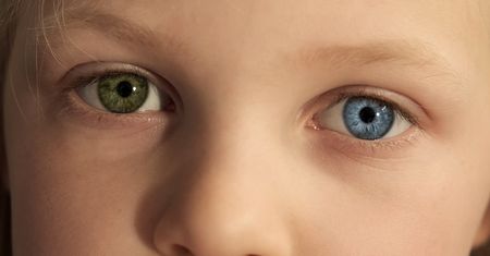 Heterochromia centralna, częściowa i całkowita. Czy jest grożna?