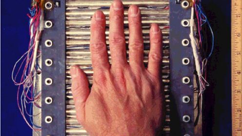 Boli? Pamiętaj - własny dotyk najlepiej łagodzi ból 1