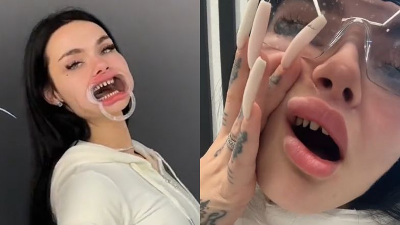 Zusje chwali się NOWYMI ZĘBAMI