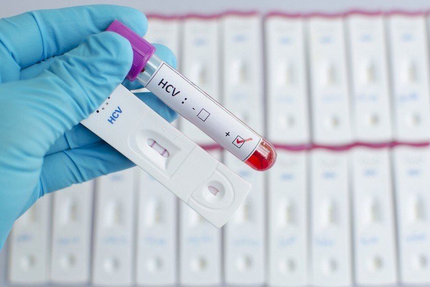 W Łodzi zrobisz bezpłatne i anonimowe badania w kierunku HIV, HCV i kiły. W tym tygodniu bada się i do badań zachęca cała Europa