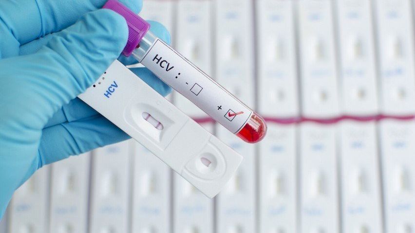 Bezpłatne badania w kierunku HIV, NCV oraz kiły.