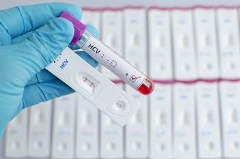 W Łodzi zrobisz bezpłatne i anonimowe badania w kierunku HIV, HCV i kiły. W tym tygodniu bada się i do badań zachęca cała Europa
