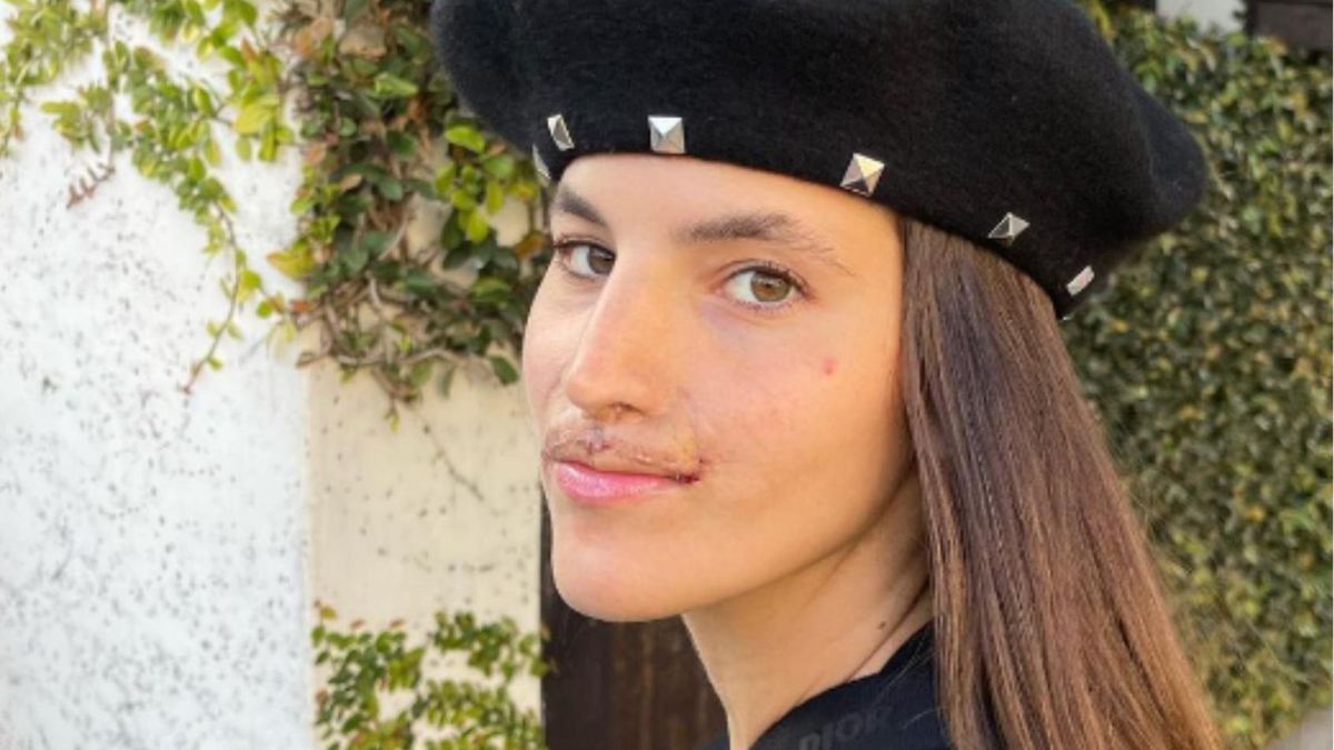 Ponad dwa lata temu **doszło do tragedii**, która na zawsze zmieniło życie młodej dziewczyny