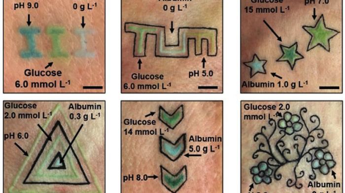 Tatuaż dla diabetyków. Zmierzy poziom glukozy 1