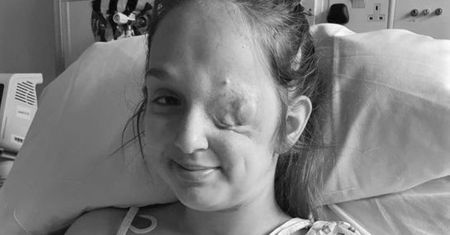 Lekarze myśleli, że to cysta. 15-latka miała rzadki nowotwór