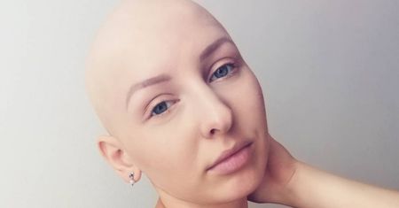 Straciła wszystkie włosy. Ola przełamuje tabu i dodaje sił innym kobietom
