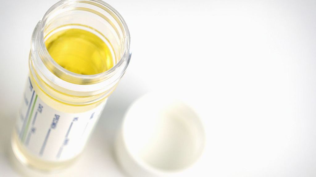 mocz covid-19 koronawirus dzieci