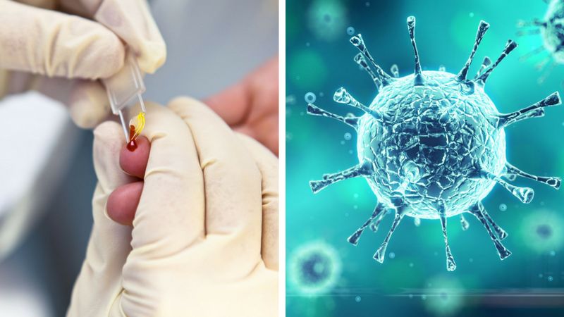 Udało się! Dziecko zarażone HIV po 9 latach jest zdrowe