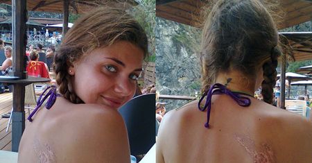 Zdarte plecy Wodzianki! (FOTO)