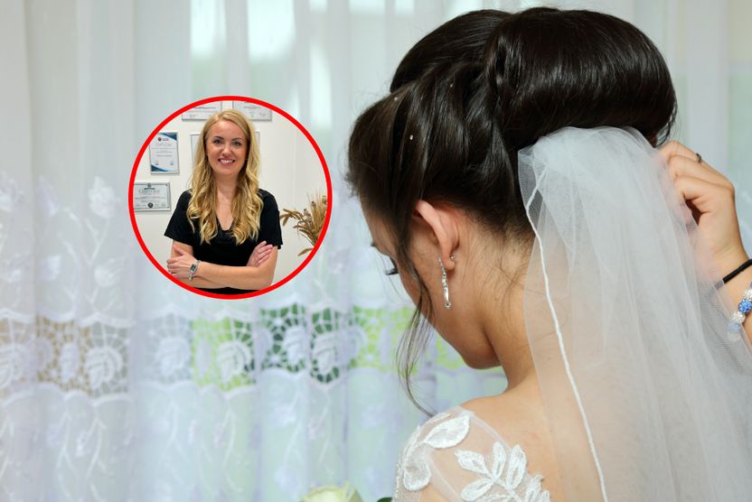 "Efekt lalki" wychodzi z mody. Lekarka mówi, co teraz kobiety poprawiają w wyglądzie