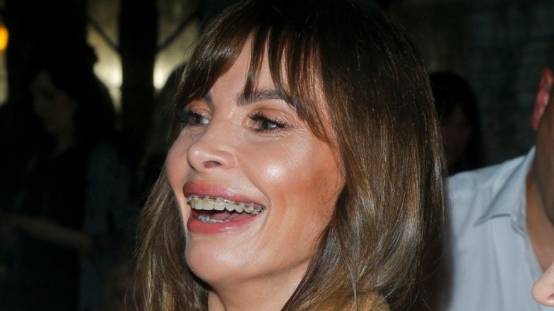 Agnieszka Dygant wydała okrągłą sumkę na nowe zęby. Kwota robi wrażenie 