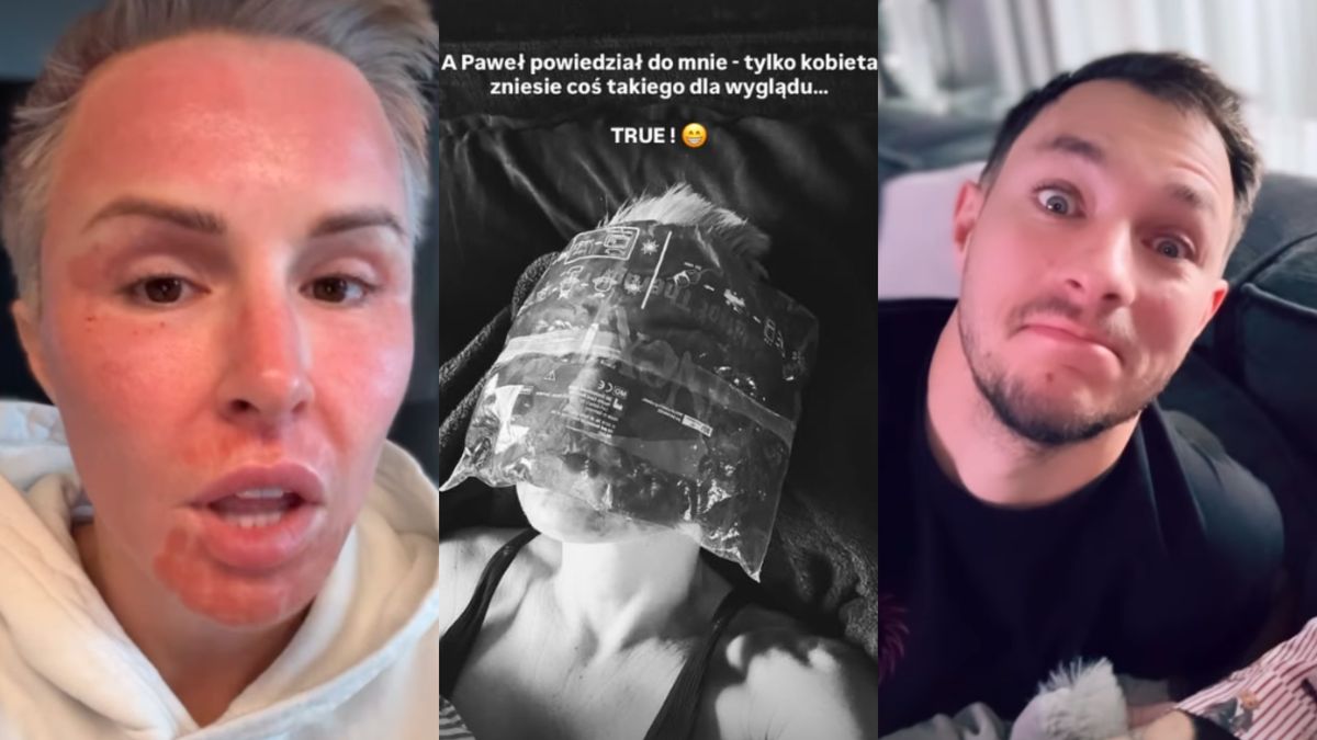 Blanka Lipińska poddała się kolejnemu zabiegowi