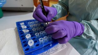 Chora na ebolę trafiła do Szwajcarii. Wcześniej przebywała w Nigerii