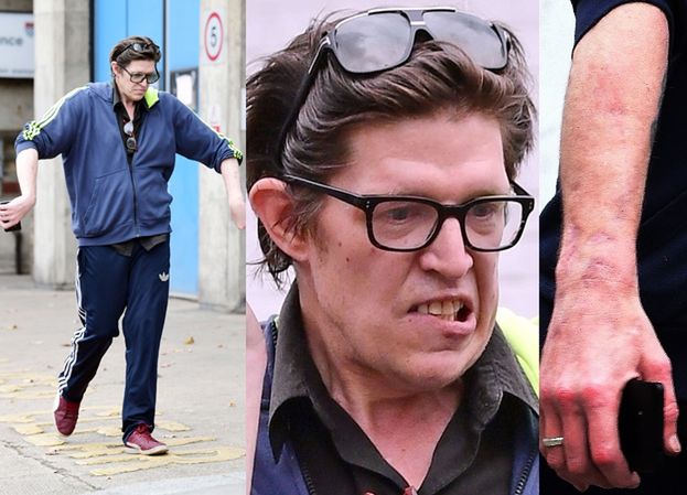 46-letni przybrany syn Pierce'a Brosnana snuje się ulicami Londynu z bliznami na rękach (FOTO)