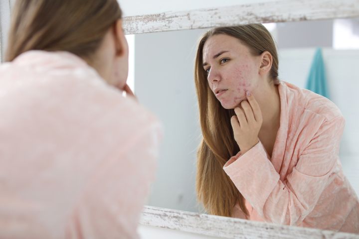 Uczulenie na twarzy może wynikać z wielu czynników jednym z nich jest alergia skórna.
