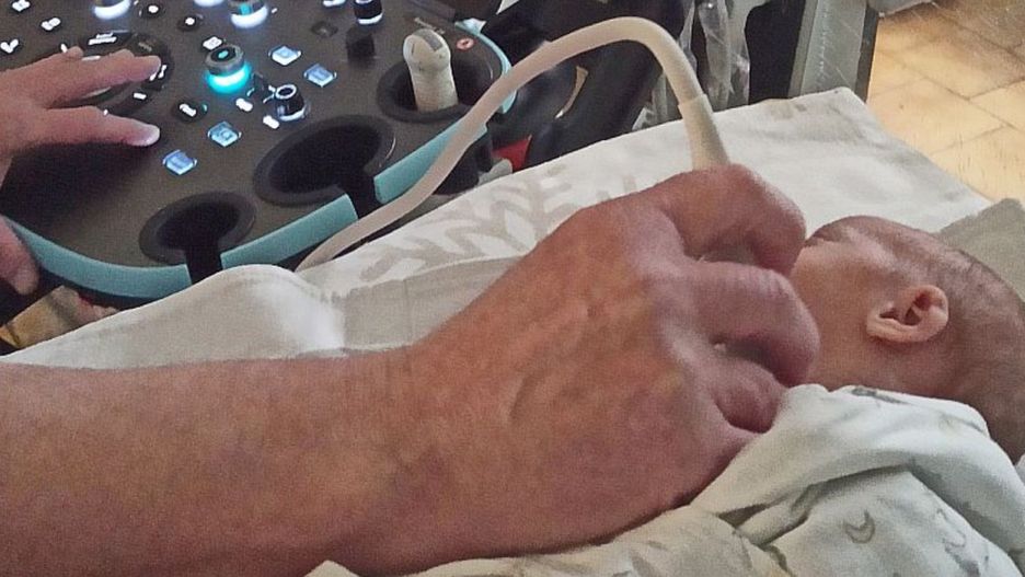 Ten sprzęt ułatwi lekarzom diagnozowanie wcześniaków i noworodków (mat. prasowe)