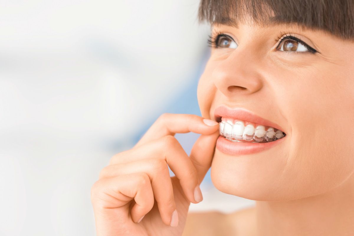 Ortodoncja może być estetyczna