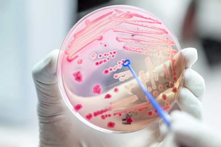 Posocznica połogowa wywołana jest najczęściej mieszanką bakterii