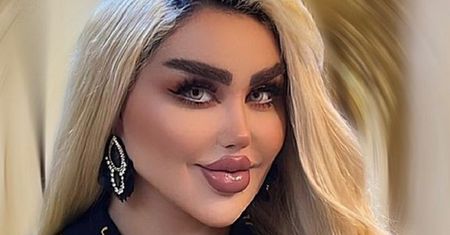 "Iracka Barbie" podbija internet. Przeszła ponad 40 zabiegów