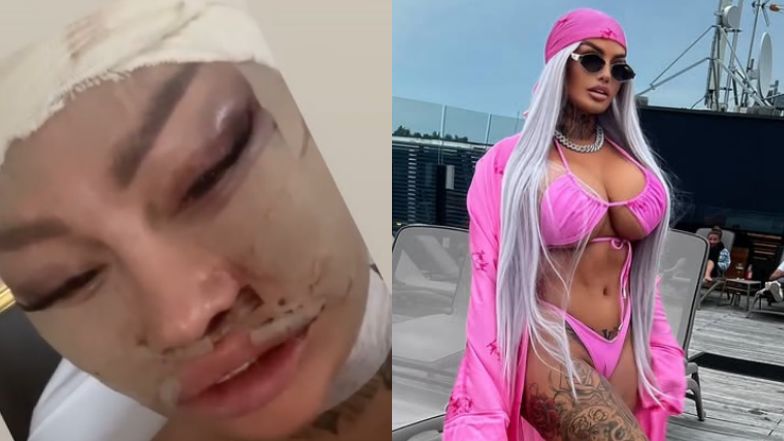 Laluna odezwała się po operacji w Turcji