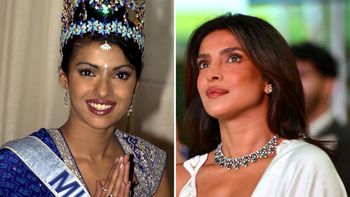 Przez nieudaną operację nosa Priyanka Chopra straciła kontrakty. "To był mroczny czas"