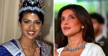 Przez nieudaną operację nosa Priyanka Chopra straciła kontrakty. "To był mroczny czas"