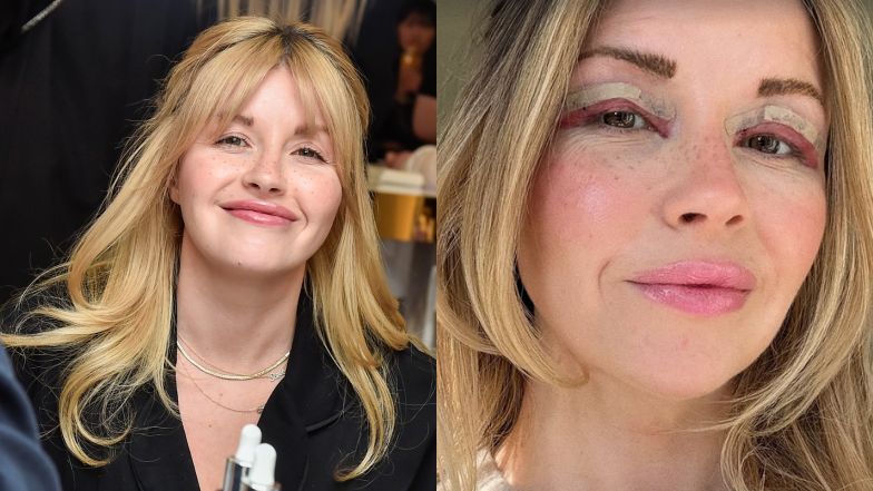 Ciocia Liestyle zoperowała powieki